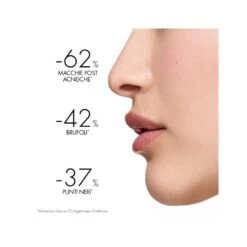 Vichy NORMADERM TRATTAMENTO QUOTIDIANO ANTI-IMPERFEZIONI 50 Ml -Ottimale Infermieristica Negozio vichy normaderm phytosolution trattamento quotidiano doppia azione pelle acneica 50ml 3 1654778242